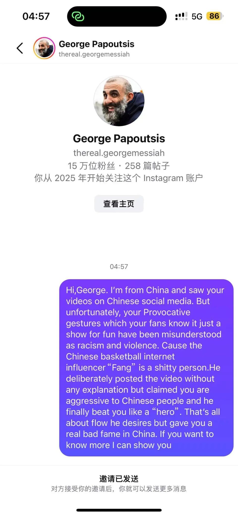 xt, 跳梁小丑